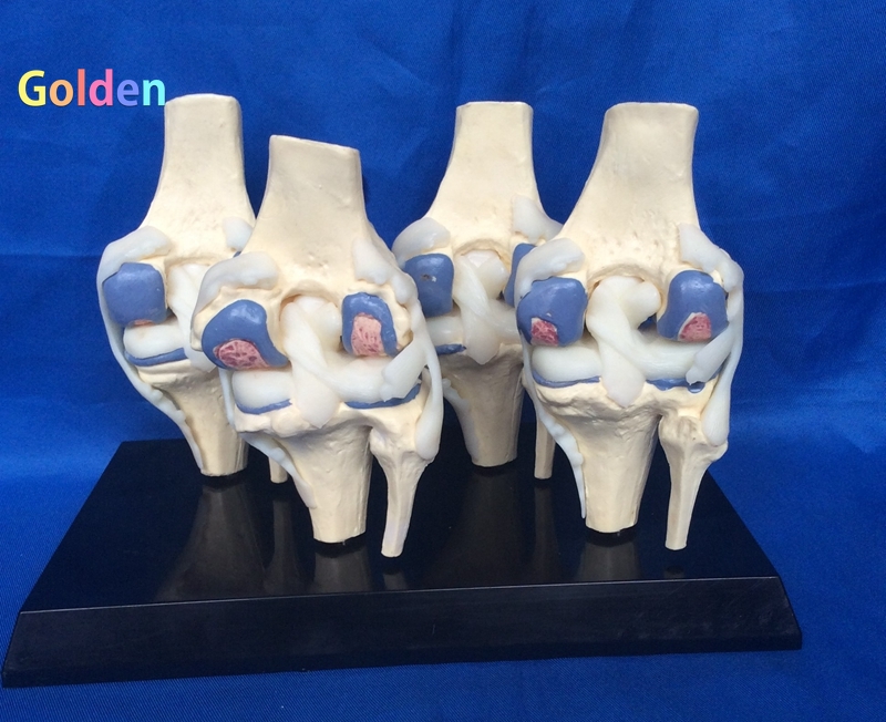 인체 1:1 무릎 관절 비교 뼈 의료 모델 의료 교육 장비 훈련 도구